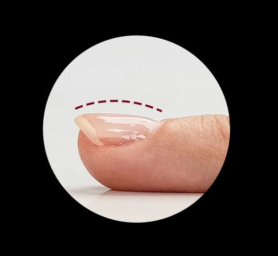 Cross-section of a builder-gel overlay on the natural nail